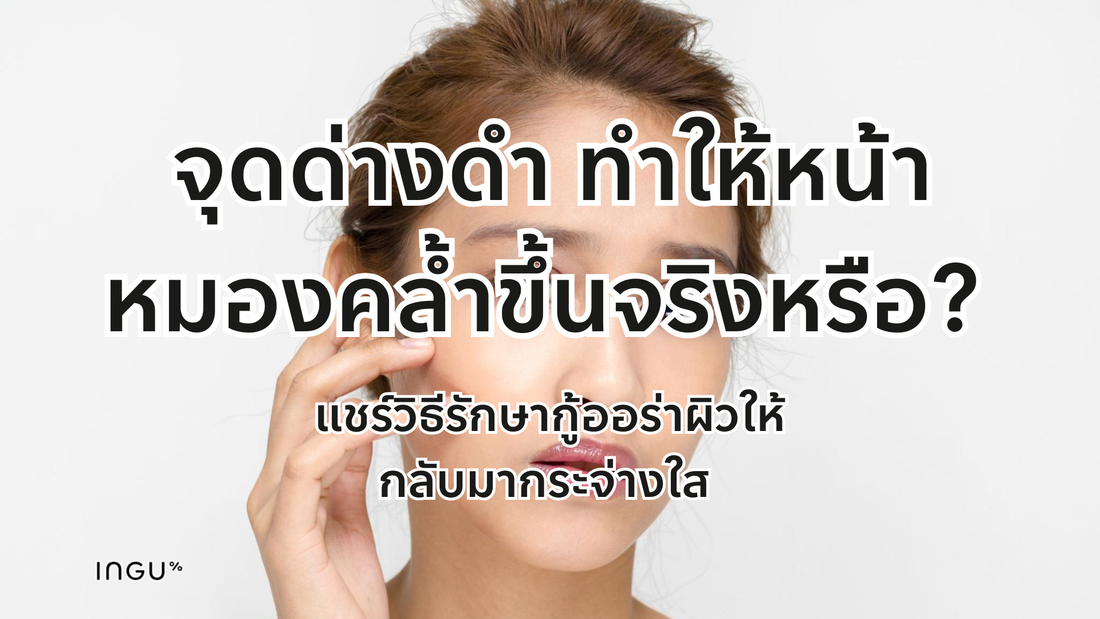 จุดด่างดำ ทำให้หน้าหมองคล้ำขึ้นจริงหรือ? แชร์วิธีรักษากู้ออร่าผิวให้กลับมากระจ่างใส