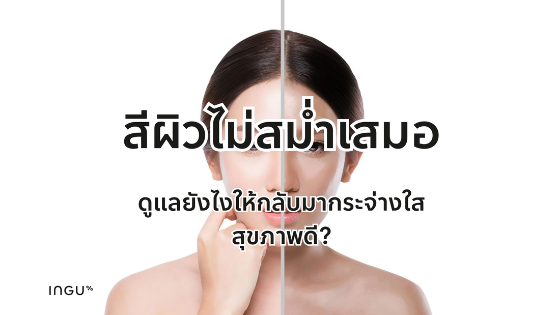 สีผิวไม่สม่ำเสมอ ดูแลยังไงให้กลับมากระจ่างใส สุขภาพดี?